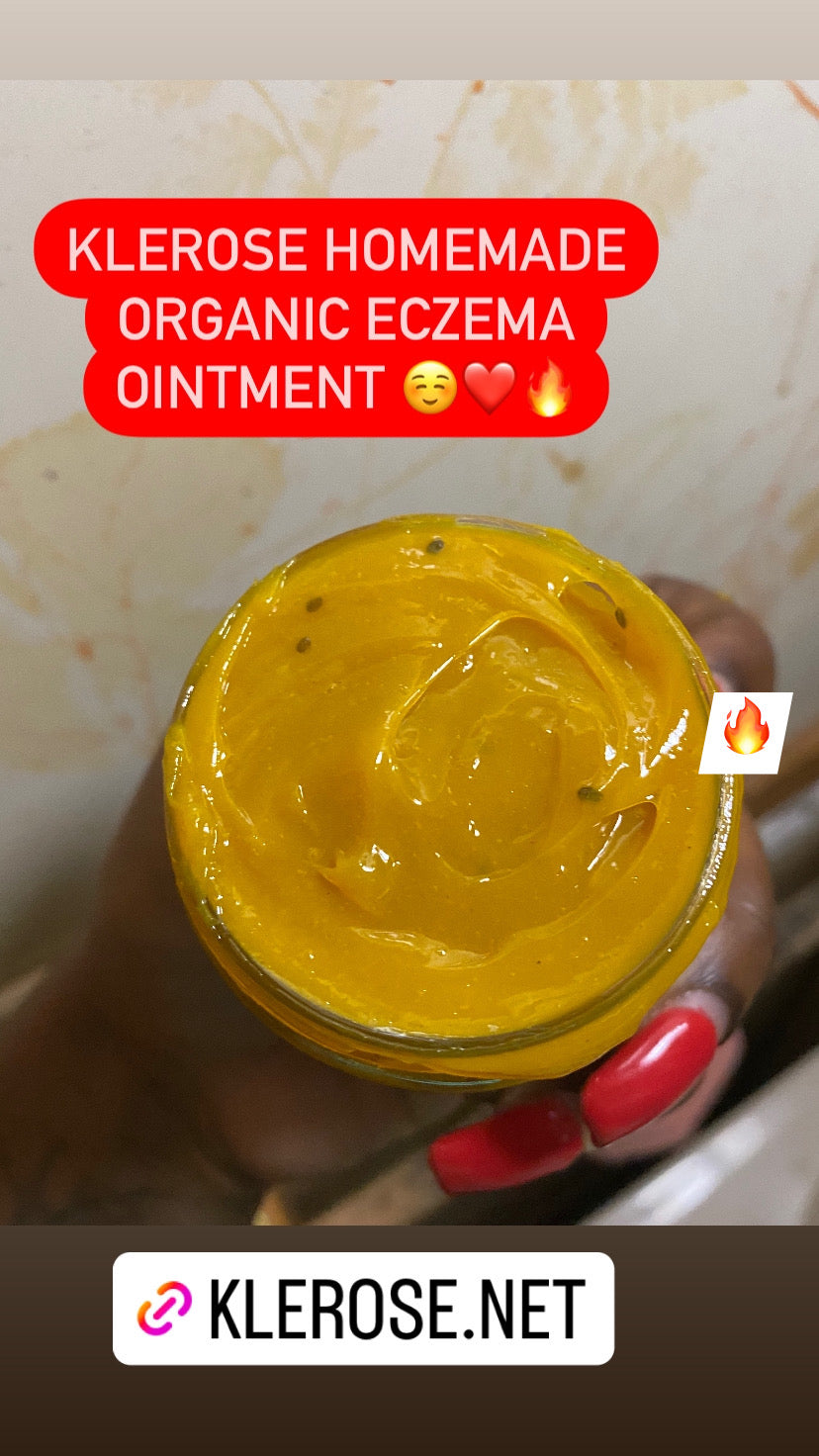 Klerose Eczema Ointment